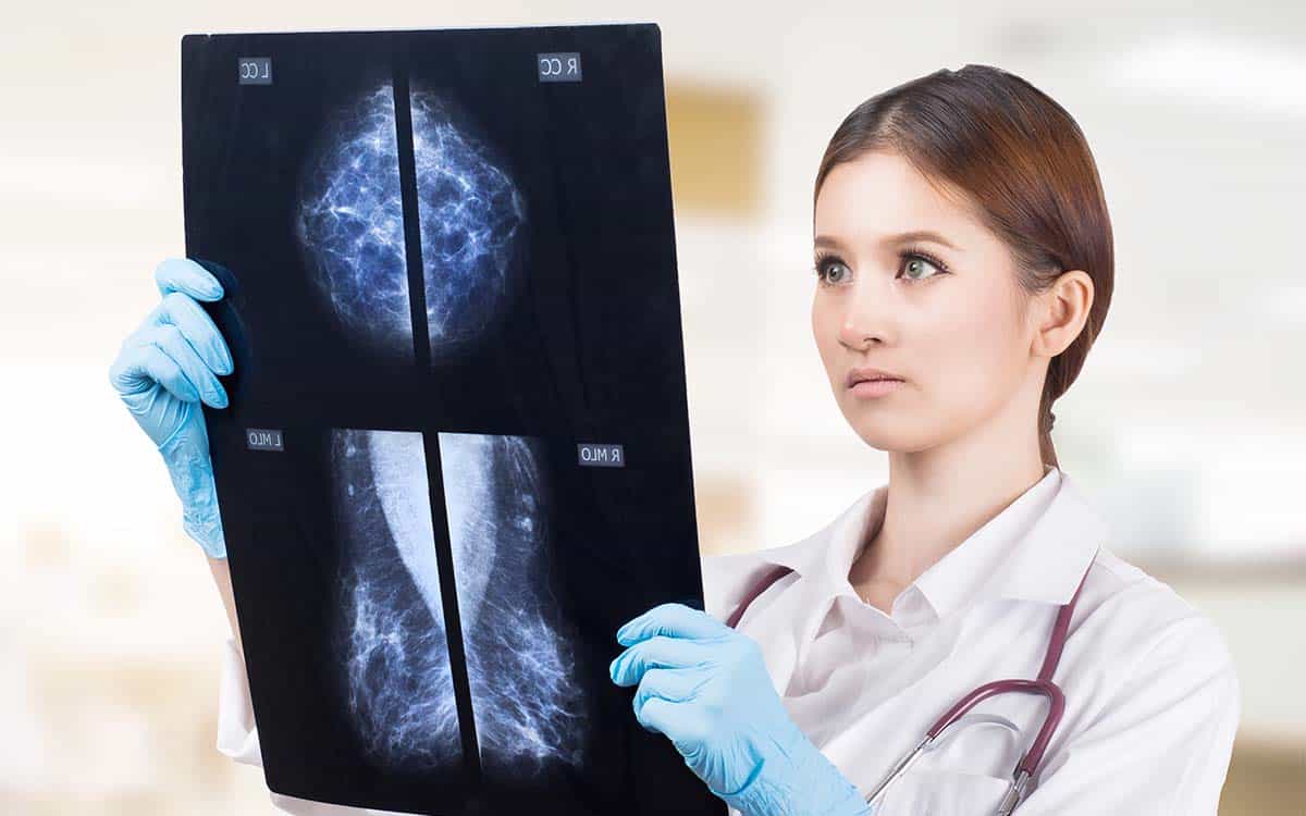 Should You Worry About Having Dense Breast Tissue?